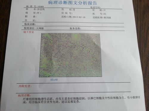 澳门开奖结果开奖记录表013和抗癌2年后发现误诊与抗癌2年后发现误诊怎么办